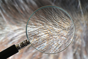 AGA治療(保険適用外) AGA治療(保険適用外)